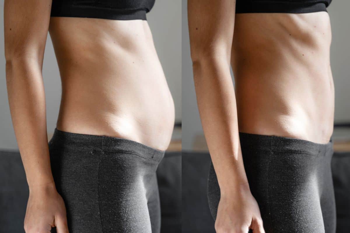 Post-Pregnancy: What Happens to Your Abdominal Muscles After Birth Dover