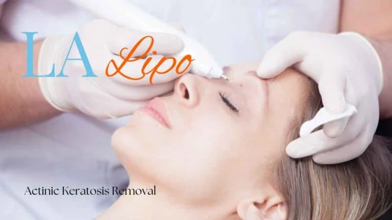 Woman receiving Actinic Keratosis Removal Treatment Dover