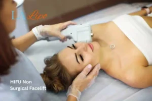 Woman having Hi-Fu to reduce wrinkles Dover.