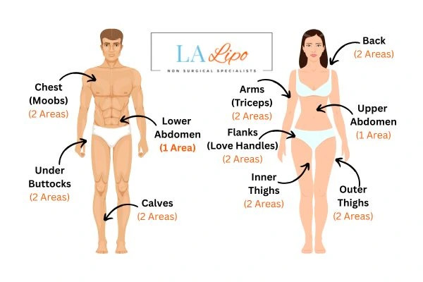 LA LIPO Cryolipolysis Areas Dover