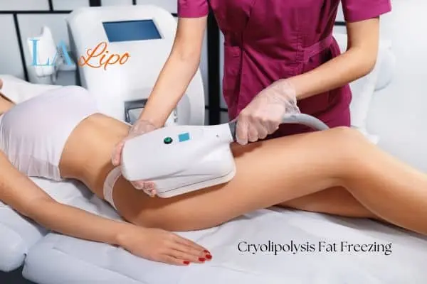 Woman receiving coolsculpting Dover treatment on her thighs