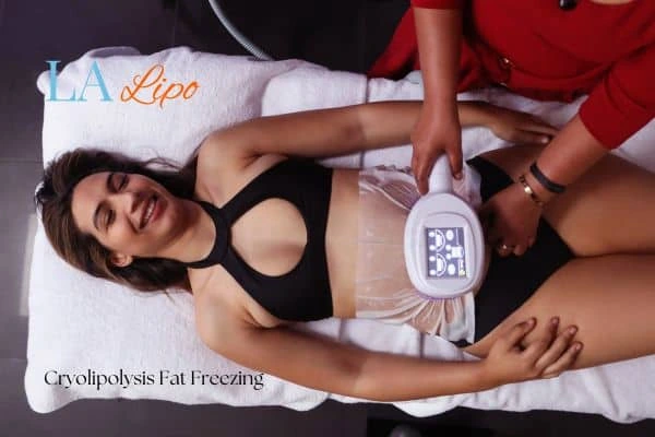 woman getting cryolipolysis Dover