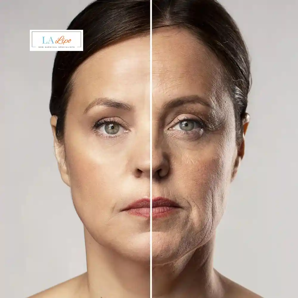 How Can You Tell If Non-Surgical Skin Tightening Is Right for You Dover?