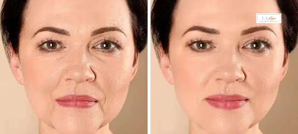 How Long Does It Take to See Results and How Long Do They Last Dover?