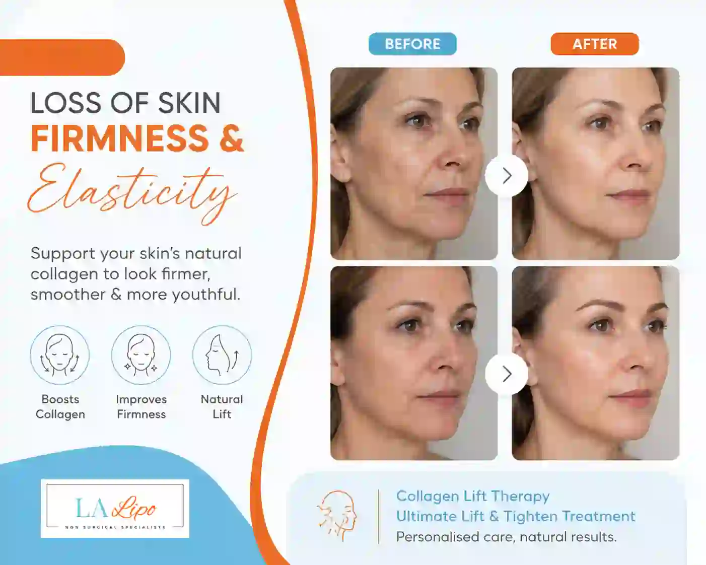 Sign #7: Loss of Skin Firmness and Elasticity Dover